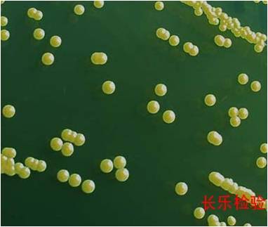 醫(yī)藥行業(yè):人體存有金黃色葡萄球菌為正常現(xiàn)象 醫(yī)藥行業(yè):人體存有金黃色葡萄球菌為正常現(xiàn)象